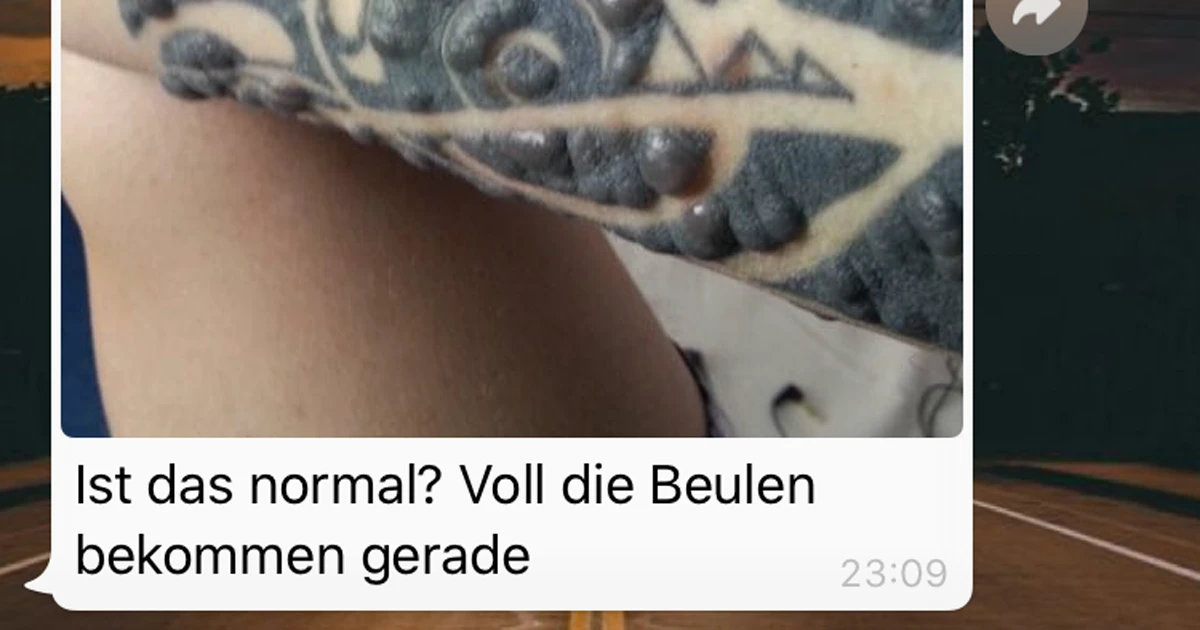 Das Tattoo sollte nicht so aussehen
